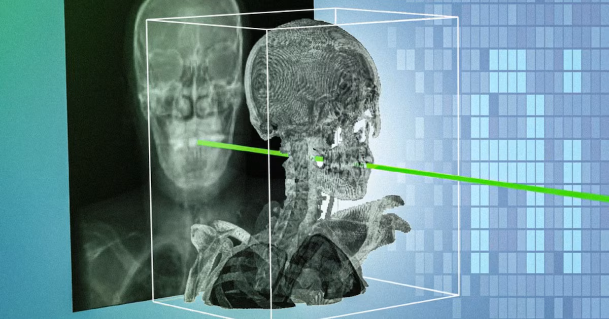 MIT desarrolla xvr, IA que orienta instrumentos quirúrgicos en tiempo real al fusionar radiografías con 3D previo